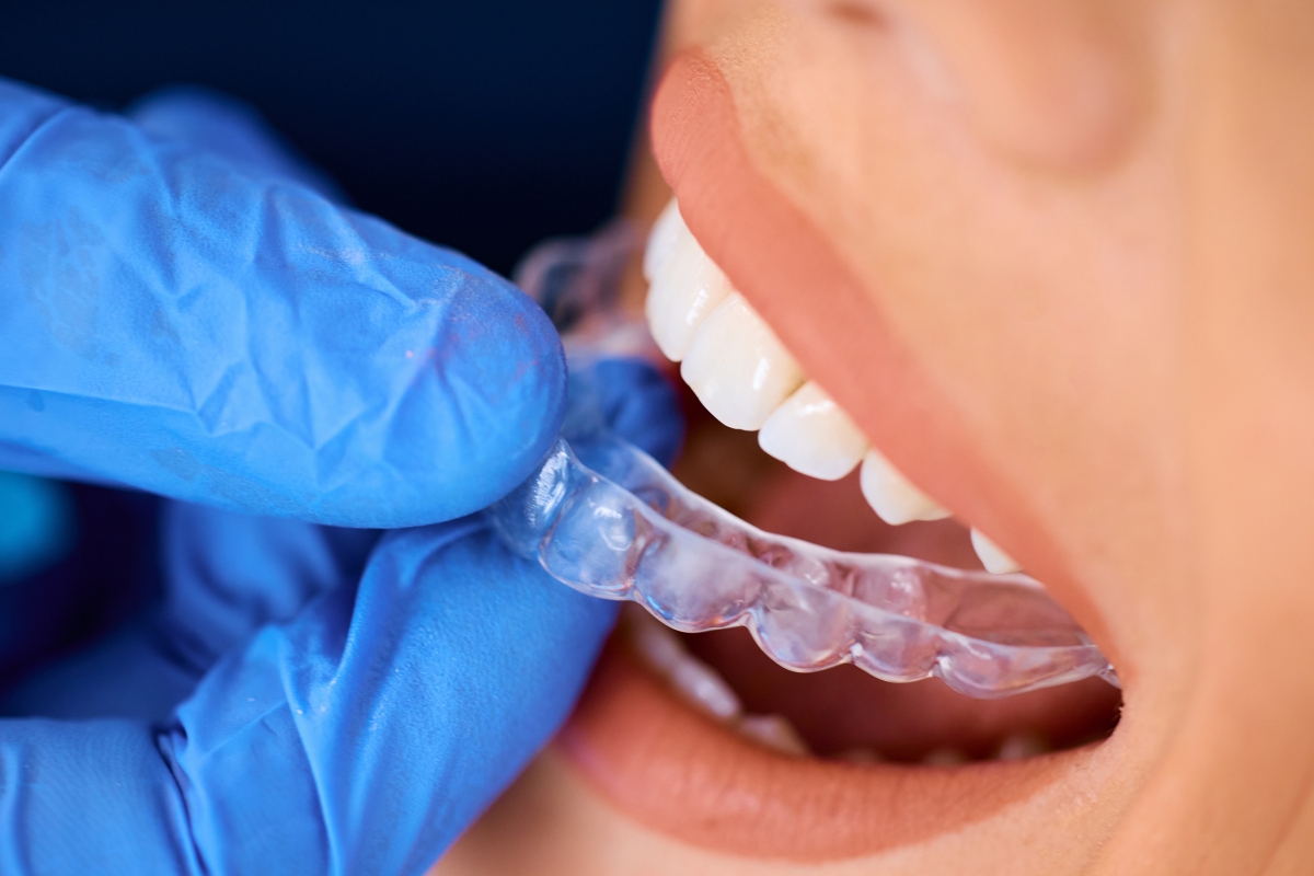 invisalign smyrna