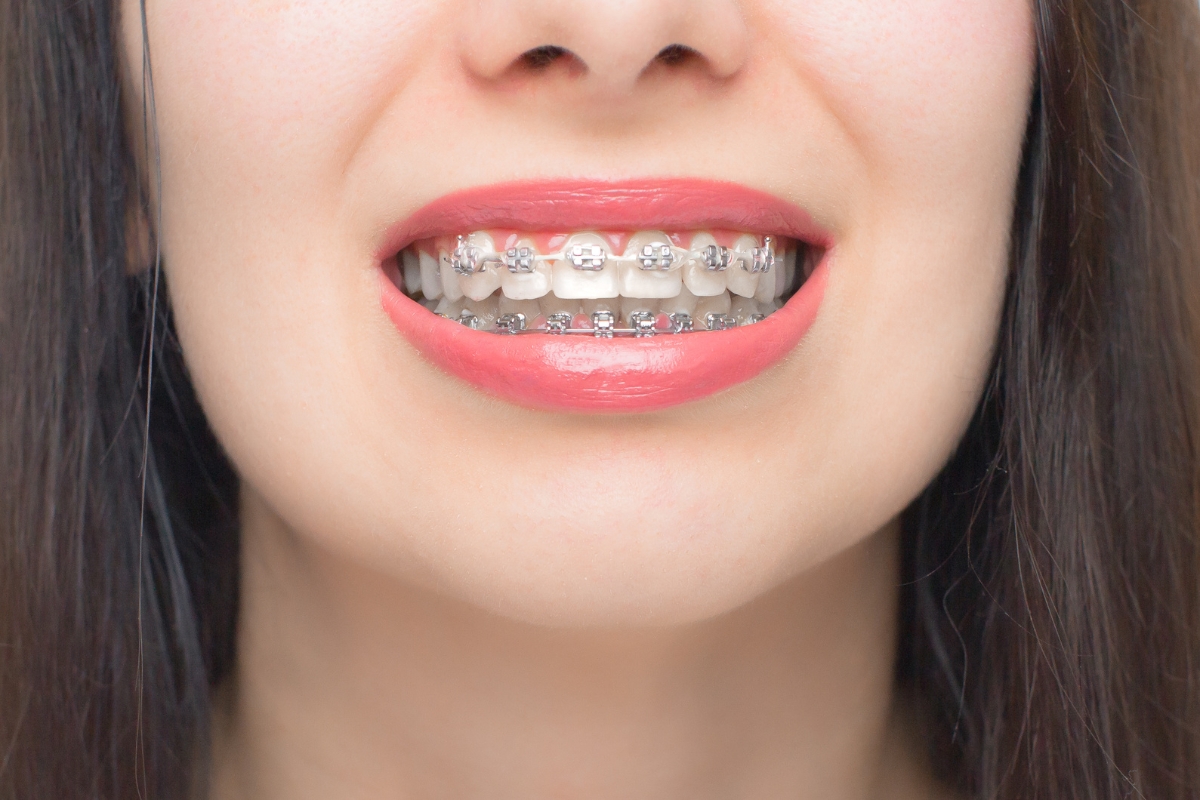 Orthodontics Franklin